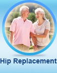 Hip Replacement - Justin Klimisch, MD - Adult Reconstruction